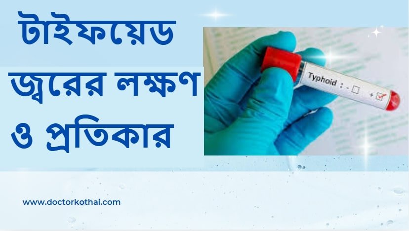 টাইফয়েড জ্বরের লক্ষণ ও প্রতিকার